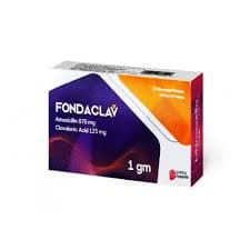 Fondaclav